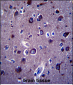 APP Antibody (Center)